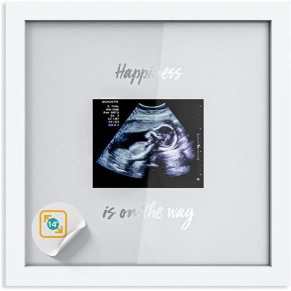 Baby Sonogram Keepsake Picture Frame, Deluxe Ultrasound Frame- Large 10”x10” - Picture 1 of 6